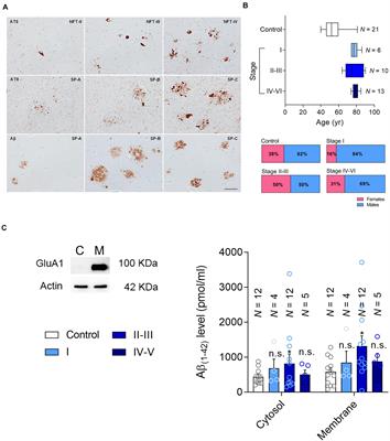 Aberrant Synaptic PTEN in Symptomatic Alzheimer’s Patients May Link Synaptic Depression to Network Failure